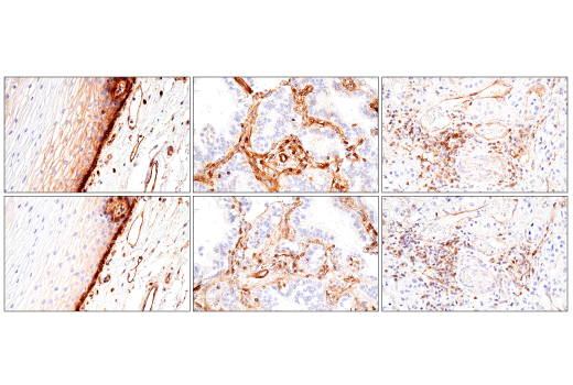 Immunohistochemistry Image 15: CD99 (PCB1) Mouse mAb