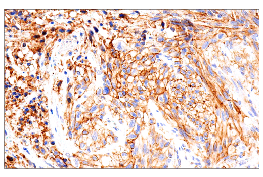 Immunohistochemistry Image 1: CD99 (PCB1) Mouse mAb