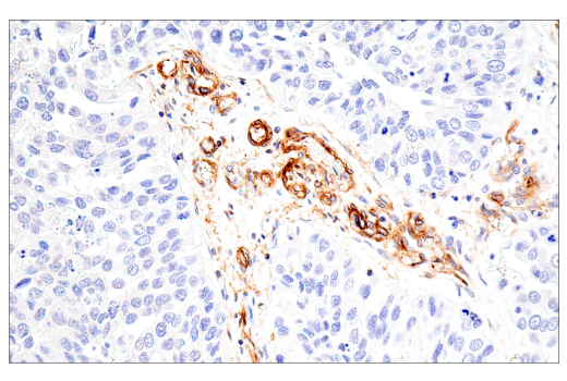 Immunohistochemistry Image 6: CD99 (PCB1) Mouse mAb