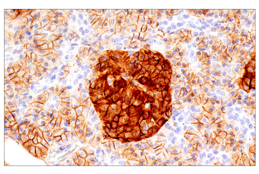 Immunohistochemistry Image 13: CD99 (PCB1) Mouse mAb