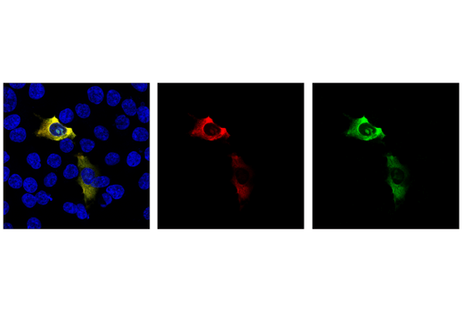 Immunofluorescence Image 1: Cas9 (S. aureus) (6H4) Mouse mAb (Alexa Fluor® 647 Conjugate)