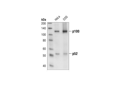  Image 6: NF-κB Family Member Antibody Sampler Kit