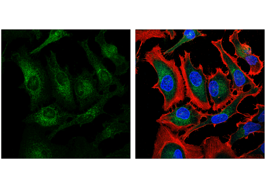 Immunofluorescence Image 2: Nicastrin (D4F6N) Rabbit mAb