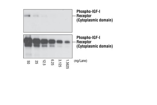 Western Blotting Image 1: Phospho-Insulin Receptor β (Tyr1361) (84B2) Rabbit mAb