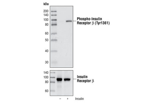 Western Blotting Image 2: Phospho-Insulin Receptor β (Tyr1361) (84B2) Rabbit mAb