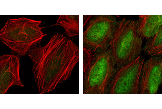 Immunofluorescence Image 1: Phospho-NF-κB p65 (Ser536) (93H1) Rabbit mAb (BSA and Azide Free)