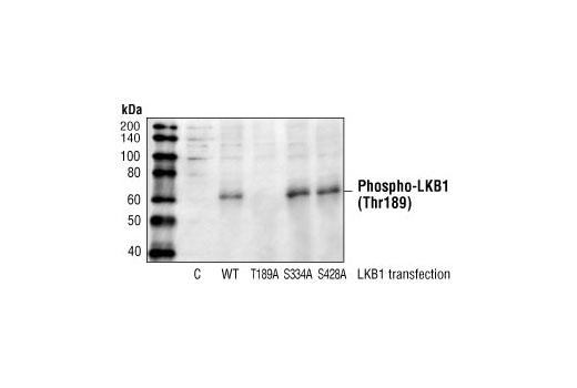 Western Blotting Image 1: Phospho-LKB1 (Thr189) Antibody