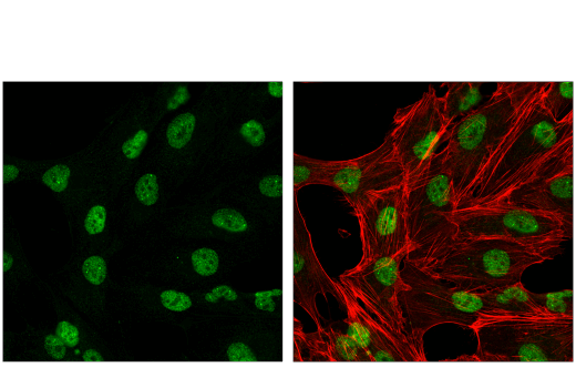 Immunofluorescence Image 1: CBX4 (E6L7X) Rabbit mAb