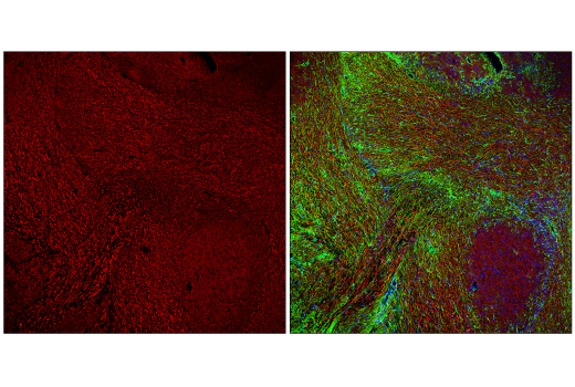 Immunofluorescence Image 2: Neurofilament-H (E7Z7G) Rabbit mAb