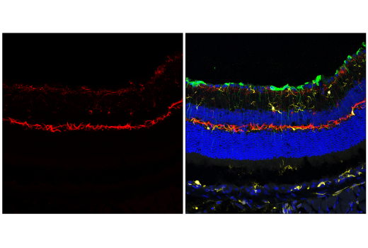Immunofluorescence Image 3: Neurofilament-H (E7Z7G) Rabbit mAb