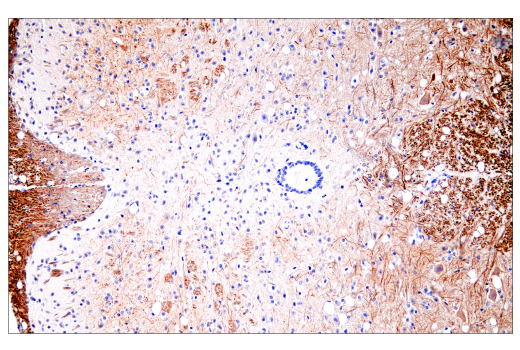Immunohistochemistry Image 6: Neurofilament-H (E7Z7G) Rabbit mAb