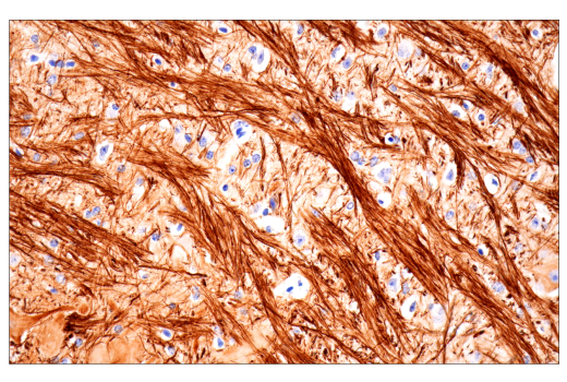 Immunohistochemistry Image 2: Neurofilament-H (E7Z7G) Rabbit mAb