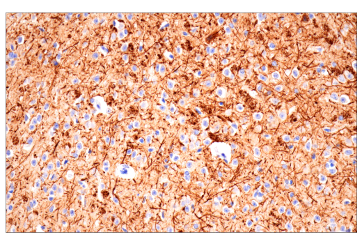Immunohistochemistry Image 1: Neurofilament-H (E7Z7G) Rabbit mAb
