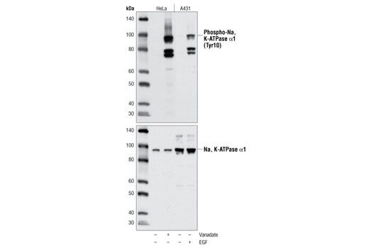 Western Blotting Image 1: Phospho-Na,K-ATPase α1 (Tyr10) Antibody