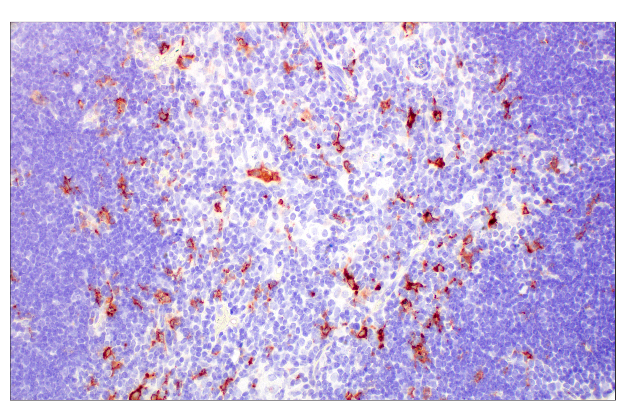 Immunohistochemistry Image 5: C1QB (E3U6X) Rabbit mAb