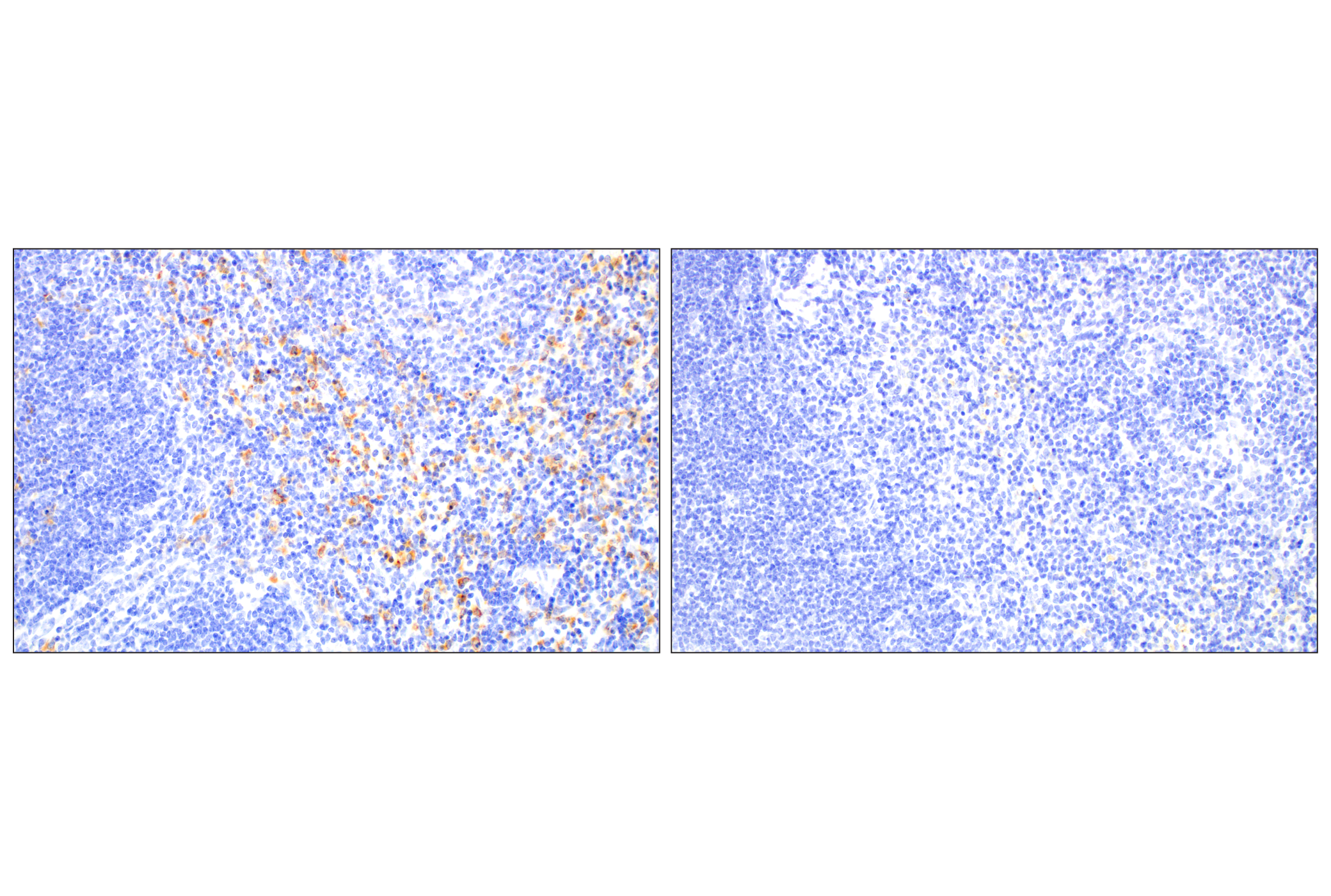 Immunohistochemistry Image 9: C1QB (E3U6X) Rabbit mAb