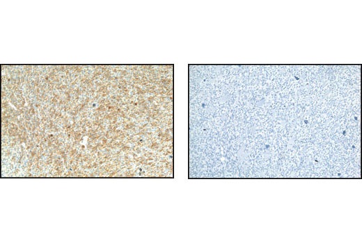 Immunohistochemistry Image 2: Phospho-Met (Tyr1234/1235) (D26) XP® Rabbit mAb (BSA and Azide Free)