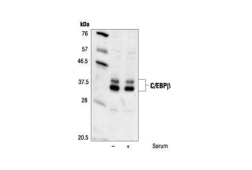 Western Blotting Image 1: C/EBPβ Antibody