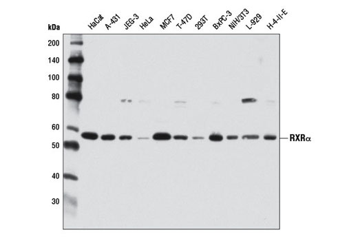  Image 1: Retinoic Acid and Retinoid X Receptors Antibody Sampler Kit