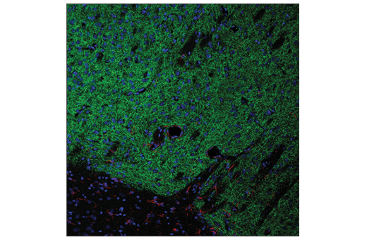 Immunofluorescence Image 1: Adora2a/Adenosine Receptor A2a (E5I8X) XP® Rabbit mAb (BSA and Azide Free)