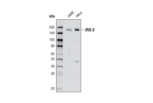 Western Blotting Image 1: IRS-2 (L1326) Antibody