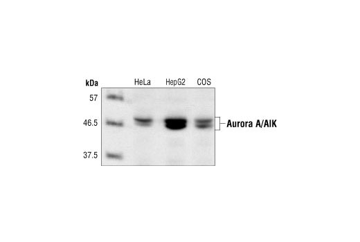 Western Blotting Image 1: Aurora A/AIK Antibody