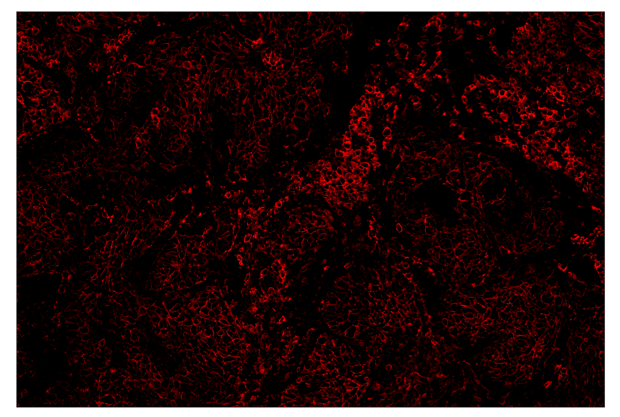 Immunohistochemistry Image 4: CD44 (E7K2Y) & CO-0030-647 SignalStar™ Oligo-Antibody Pair