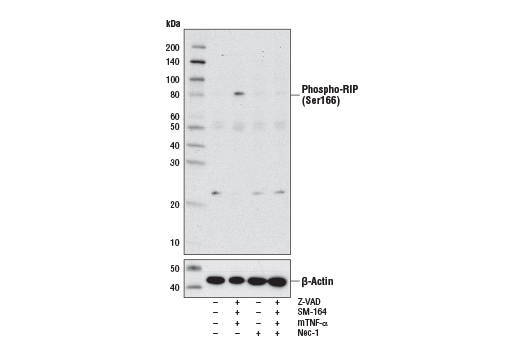 Western Blotting Image 1: Phospho-RIP (Ser166) Antibody