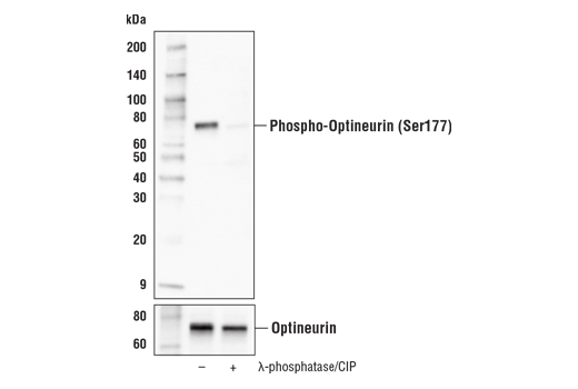 Western Blotting Image 3: Phospho-Optineurin (Ser177) (E8L9I) Rabbit mAb