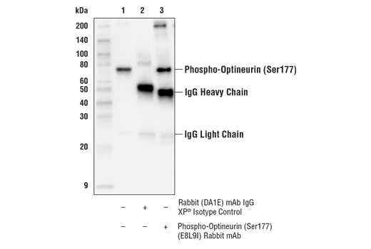 Immunoprecipitation Image 1: Phospho-Optineurin (Ser177) (E8L9I) Rabbit mAb