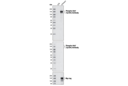 Western Blotting Image 1: Phospho-Ack1 (Tyr284) Antibody