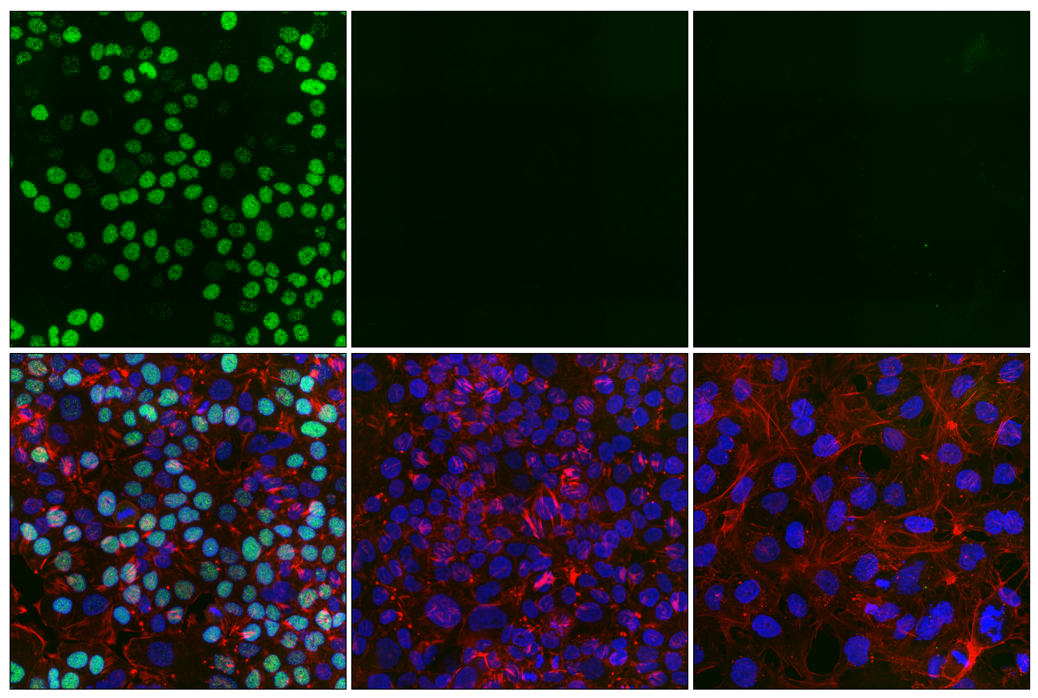 Immunofluorescence Image 1: Phospho-Rb (Thr821) (E6J1L) Rabbit mAb