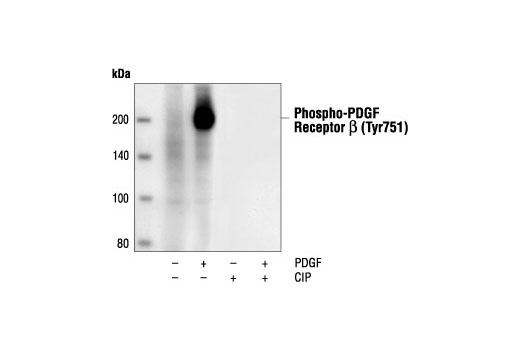 Western Blotting Image 1: Phospho-PDGF Receptor β (Tyr751) (88H8) Mouse mAb