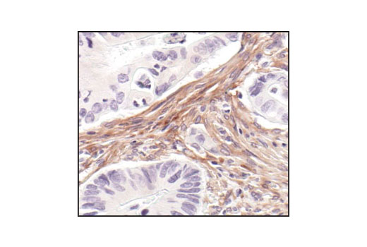  Image 11: Cancer Associated Fibroblast Marker Antibody Sampler Kit