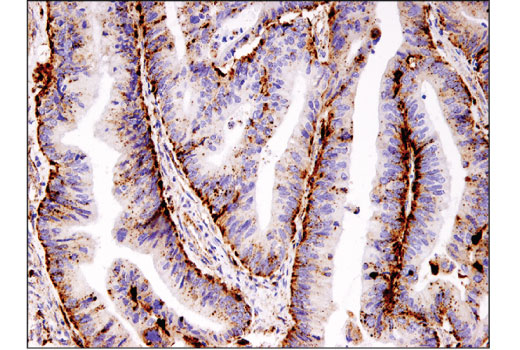  Image 21: Coronavirus Host Cell Attachment and Entry Antibody Sampler Kit