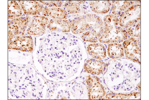  Image 29: Mouse Reactive Alzheimer's Disease Model Microglia Phenotyping IF Antibody Sampler Kit