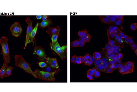  Image 47: Mouse Reactive Alzheimer's Disease Model Microglia Phenotyping IF Antibody Sampler Kit