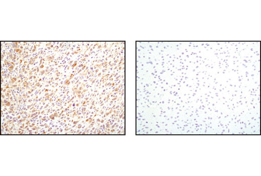  Image 23: Cancer Associated Fibroblast Marker Antibody Sampler Kit