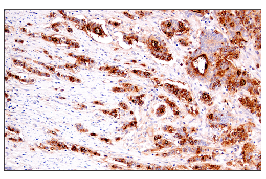 Immunohistochemistry Image 2: DAF/CD55 (E7G2U) XP® Rabbit mAb (BSA and Azide Free)