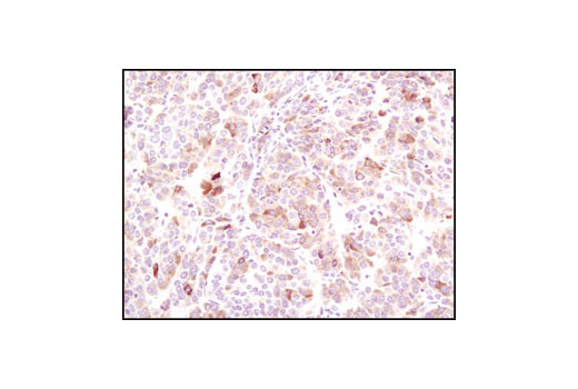 Immunohistochemistry Image 2: BiP (C50B12) Rabbit mAb (BSA and Azide Free)