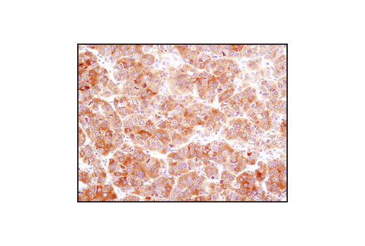  Image 19: Adipogenesis Marker Antibody Sampler Kit