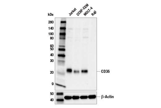 Western Blotting Image 1: CD3δ Antibody