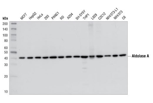 Western Blotting Image 1: Aldolase A Antibody