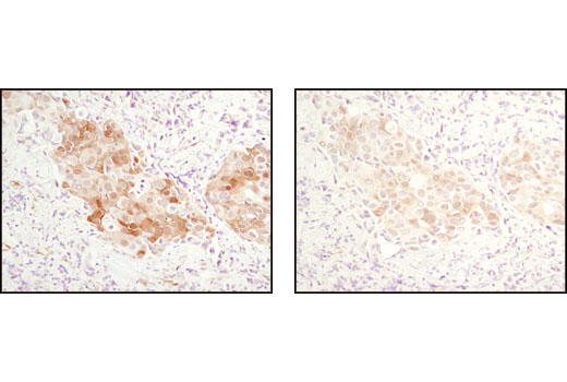 Immunohistochemistry Image 7: Phospho-Akt (Ser473) (D9E) XP® Rabbit mAb (BSA and Azide Free)
