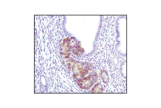 Immunohistochemistry Image 2: Phospho-Akt (Ser473) (D9E) XP® Rabbit mAb (BSA and Azide Free)