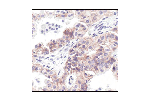 Immunohistochemistry Image 2: E-Cadherin (24E10) Rabbit mAb