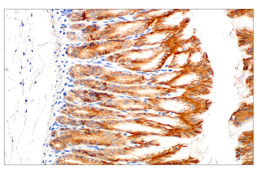  Image 31: Epithelial-Mesenchymal Transition (EMT) IF Antibody Sampler Kit