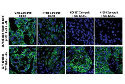  Image 66: Lung Cancer RTK Antibody Sampler Kit