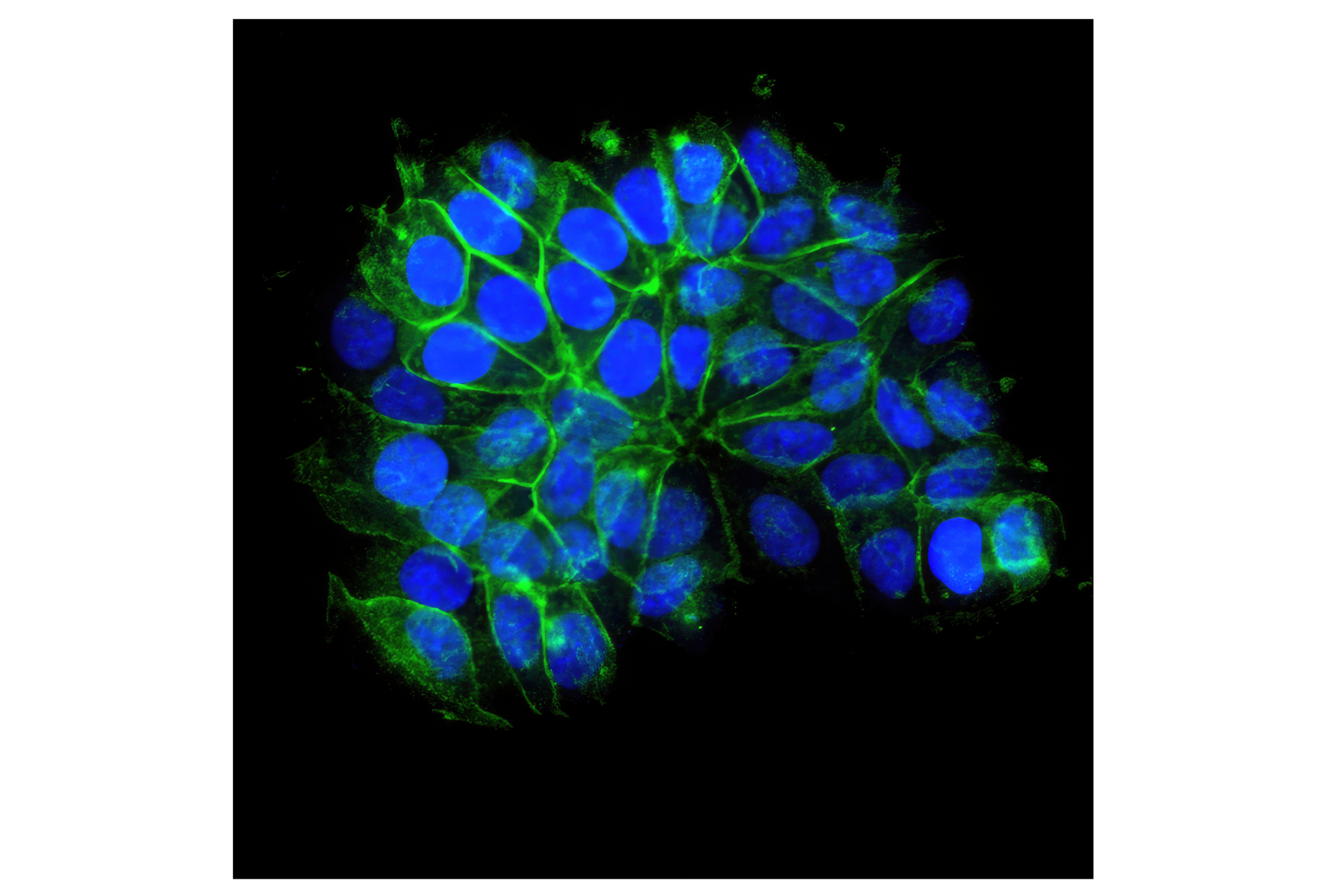 Immunofluorescence Image 1: E-Cadherin (24E10) Rabbit mAb (Alexa Fluor® 488 Conjugate)