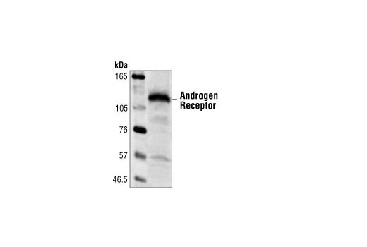 Western Blotting Image 1: Androgen Receptor Antibody